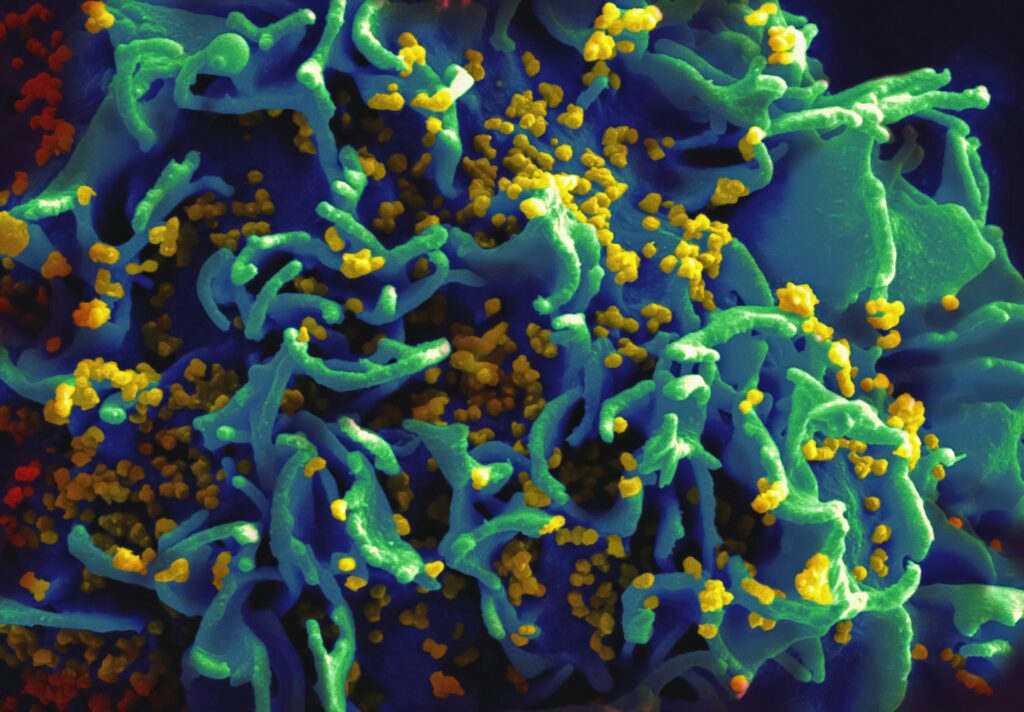 A voce alta - dialoghi sull'Hiv