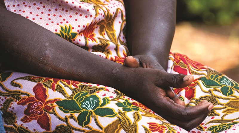 Scopri il reportage fotografico di Giada Antonini sulle donne sopravvissute alla guerra in Uganda, promosso da Insieme per Mano ETS. Date della mostra a Bergamo e Viterbo.